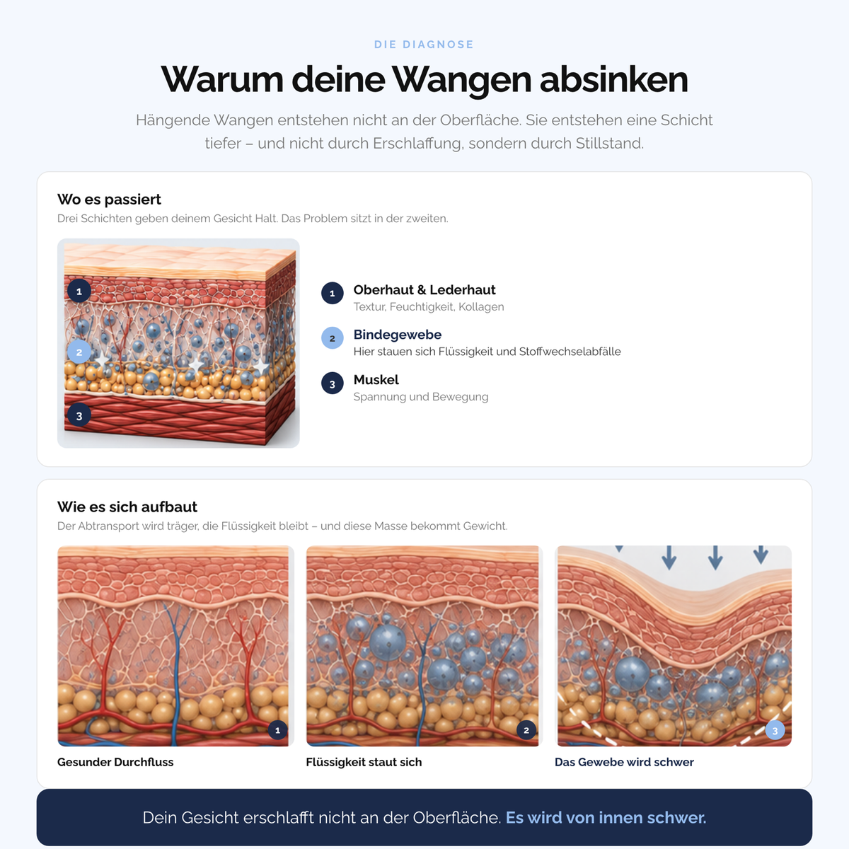 Warum Wangen absinken: die Struktur unter der Haut