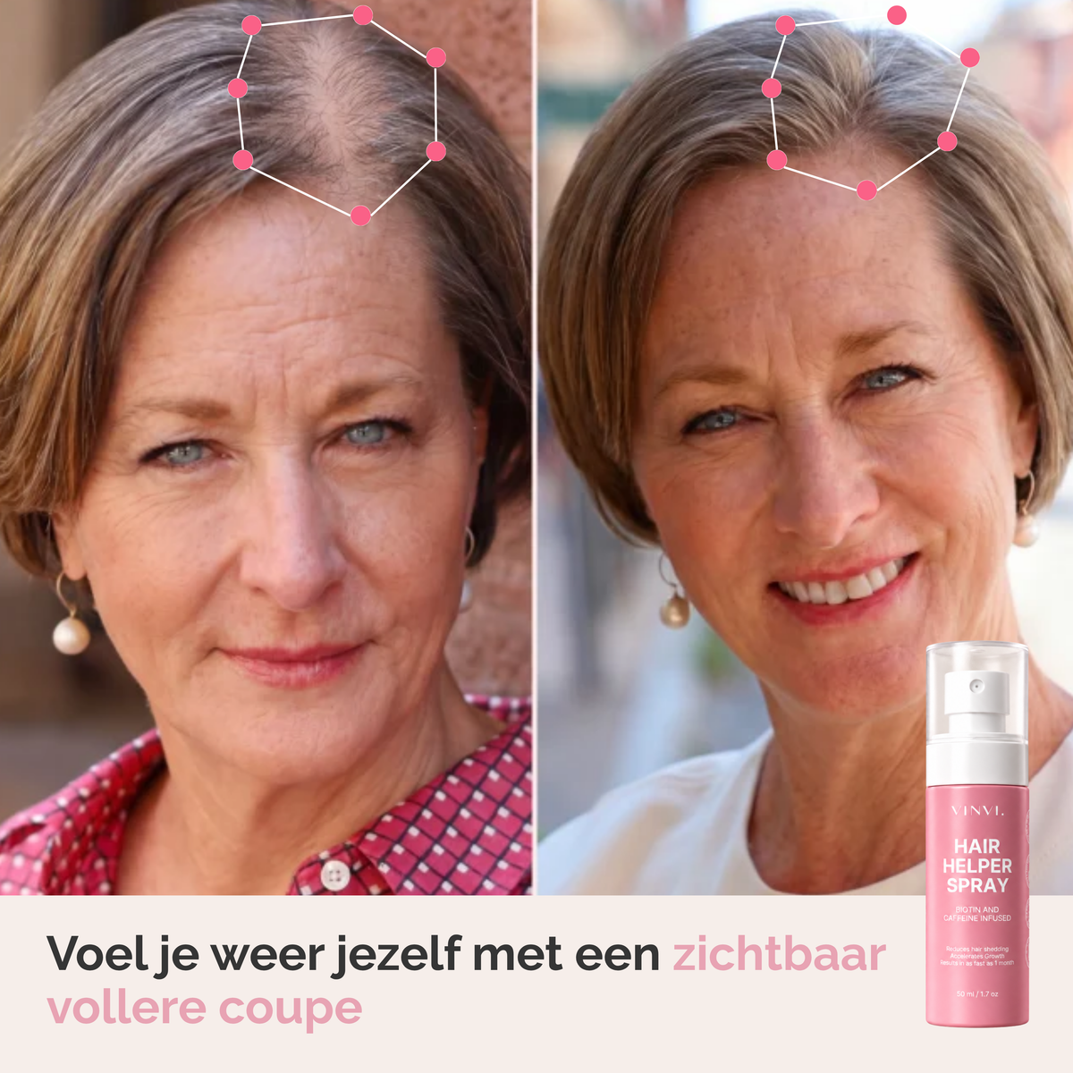 VINVI Hair Growth Spray | Specially developed for the mature scalp after menopause