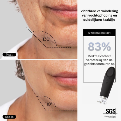 VINVI DERMAGLOW | ACTIVATE YOUR SKIN NATURALLY FROM WITHIN