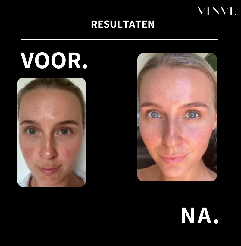Professional skincare without salon prices