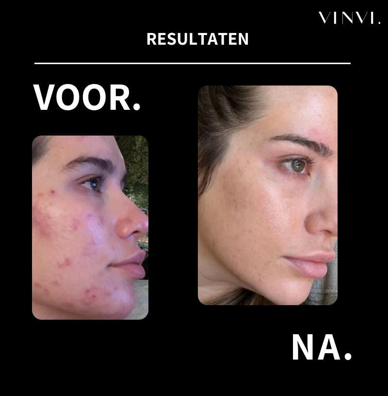 Professional skincare without salon prices