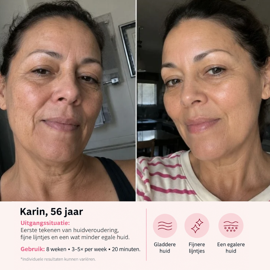 VINVI ACTIVESKIN LED MASK | FIRMER SKIN WITH A HEALTHY GLOW