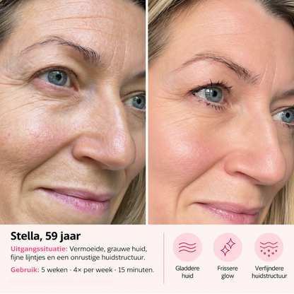 VINVI ACTIVESKIN LED MASK | FIRMER SKIN WITH A HEALTHY GLOW