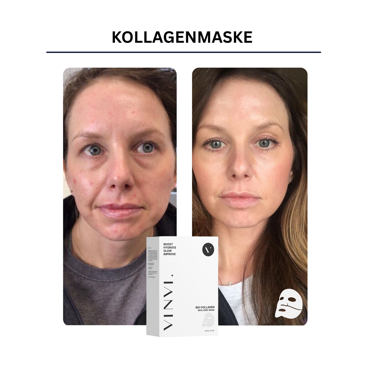 Low-molecular collagen and hyaluronic acid